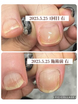 ブロックファイブハナ(Block 5 HANA)/