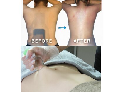 ジュエリーボディー(Jewelry body)の写真