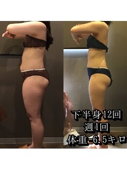 カルム エ コンポーゼ(Calme et Compose')/痩身セルゼロ/下半身12回