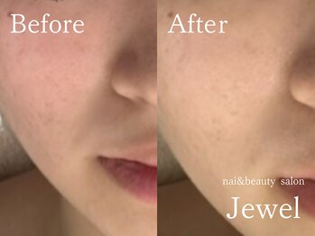 ジュエル(Jewel)/マグマハーブ一回の効果