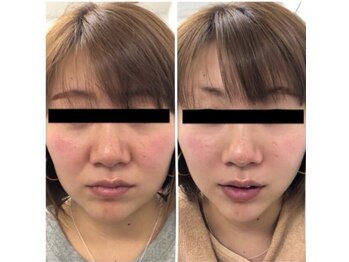 ビューティーサロンリノ 三宮店(Lino)/