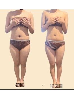 エステサロン ジュブリー/【ブライダル前の痩身12回】