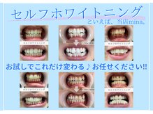 ミナ(mina)の雰囲気(ホワイトニング歴4年、実績多数!細かい部分も丁寧にサポート☆)