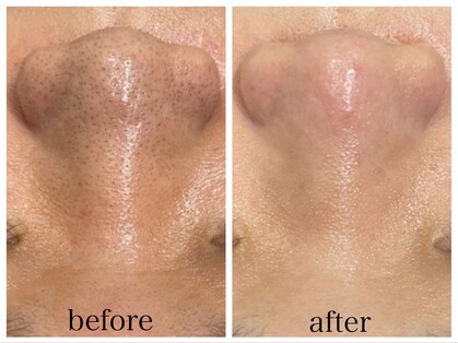 アリエスの写真