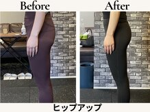 レガリス(REGALIS)/before/after ヒップアップ