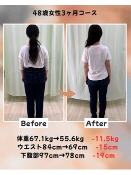 くさば整骨院/48歳女性/ダイエット3か月コース