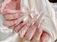 エスアイネイル(SI Nail)の写真