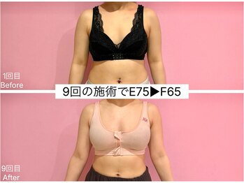 ククナ 新潟本店(KUKUNA)/*バストアップケア*