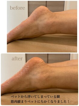 ビアージュ ナガクテ(Beage nagakute)/第二の心臓足のケアしましょう