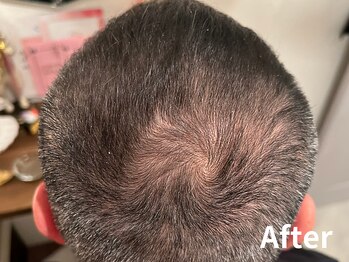 ダイヤモンド リーエンダ(Diamond leende)/クレイハーブピーリング