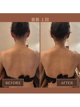 ファミーユ 名古屋店/【首、肩ケア1回】