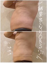 OBS新潟整骨院/男性もカッコイイ体型に！