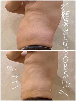 OBS新潟整骨院/男性もカッコイイ体型に！