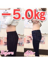 整体院 トトノウ(TotonoU)/５キロ以下のダイエットも可！！