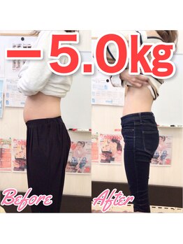 整体院 トトノウ(TotonoU)/５キロ以下のダイエットも可！！