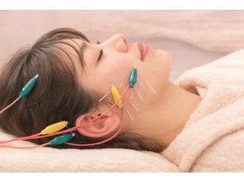 モッチ 天神大名店(MOCCHI)/リラックス美容鍼