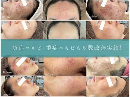 ルンソルテ(lunsoleto)の写真