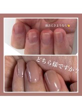 スターネイル(Starnail)/深爪噛み爪さんも縦長美爪へ
