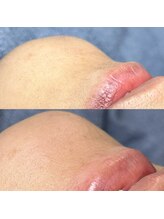 ネージュ(Neige)/顎にもふぁさー！があった