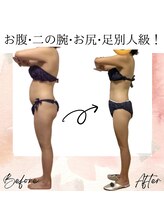 サロン ド ボーテ ラーンジュ 岐阜店(salon de beaut'e L'ange)/ハイパ-ナイフEX2ダイエット痩身