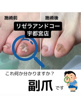 リゼラアンドコー 宇都宮店/