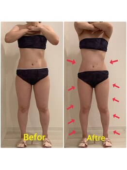 スペチアーレ 夙川/要らない脂肪や浮腫みとサヨナラ