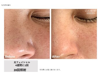 シズク ビューティーサロン(SHIZUKU beauty salon )/