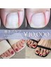 巻き爪ケア+FOOTジェル(在庫処分カラー限定)¥12,000→¥10,000