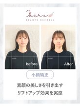 イカル 池袋(ikaru)/小顔矯正 before after 