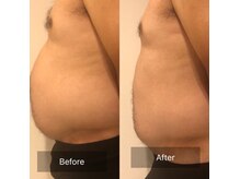 レガリア(LEGAREA)の雰囲気(【BODY痩身】キャビテーション+ラジオ波同時施術可★男性も可)