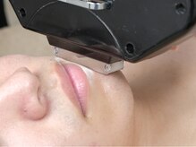 リンクサロン(Rnk.salon)/男性 &nbsp;ヒゲ脱毛