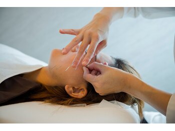 デルタエヌピー63+(δnp63+)/お客様施術例【小顔/薬院/福岡】