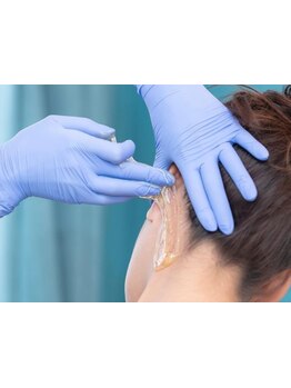 パーツ脱毛のできるサロン