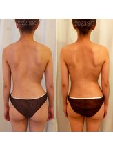 ミールーム(mi room)/整体、小顔矯正、バストケア１年