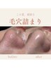 【夏限定/ピュアビタミン】黒ずみ毛穴改善＋LDMで小顔＋白玉韓国肌管理＋VC5%