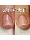 剥離の変化