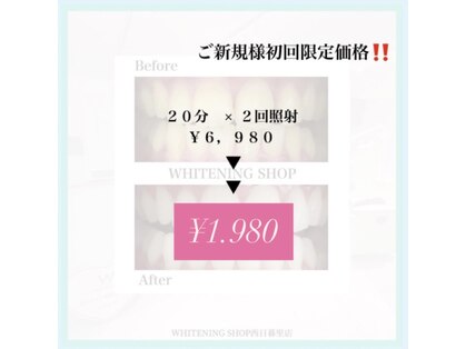 ホワイトニングショップ 西日暮里店の写真