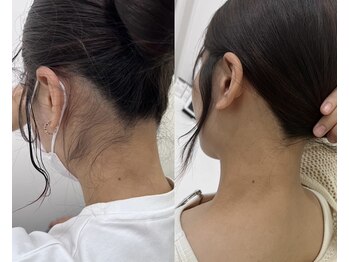 ミース 福岡本店/うなじ矯正◆ビフォーアフター