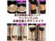 ラウレア(Laule’a)の写真