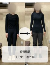 伊集院鍼灸整骨院 千葉中央院/姿勢矯正、巻き肩、くびれ