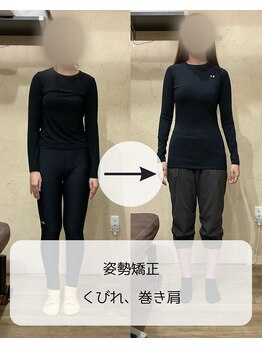 伊集院鍼灸整骨院 千葉中央院/姿勢矯正、巻き肩、くびれ