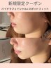 【毛穴洗浄/小顔たるみケア】ハイドラ+スポットフィット¥13000