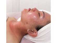 ミニョンボーテ(mignon beaute)の雰囲気（赤みは血流が高まったサイン。ハリ・艶肌    血流ケア施術）