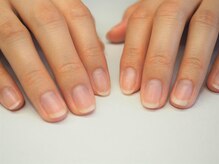 ニコプラス(NICO+)/1　カウンセリング・写真撮影