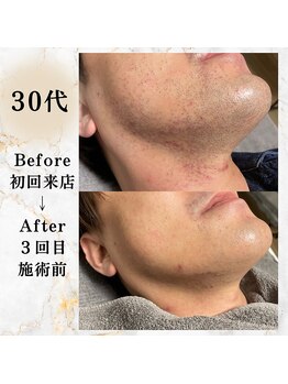 コミチ(KOMICHI)/ビフォーアフター