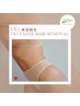 【ご新規様限定】脱毛500円OFF！［VIO］女性