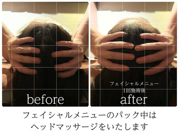 ライフチャージ(Life Charge)/パック中のヘッドも大人気★