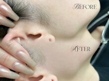 シルネ 三軒茶屋(Cilune)/フェイスワックス/フルフェイス