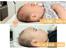 ラフィング(Laughing)/赤ちゃん整体