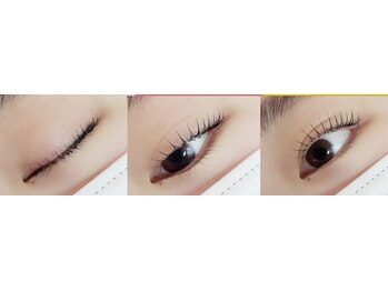 クリアーズ ビューティー(CCLEAR’S BEAUTY)/